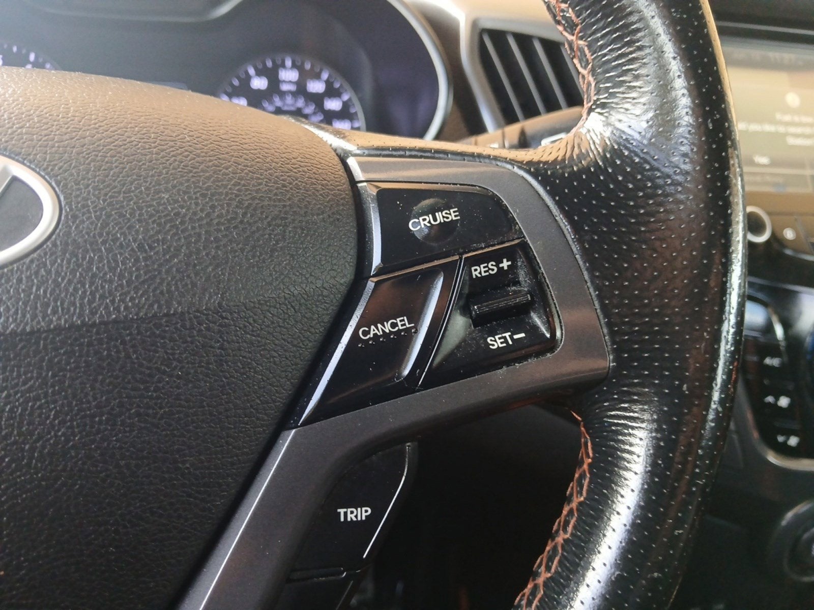 2016 Hyundai VELOSTER Turbo
